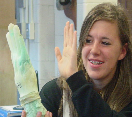 Allison F. and the fake hand